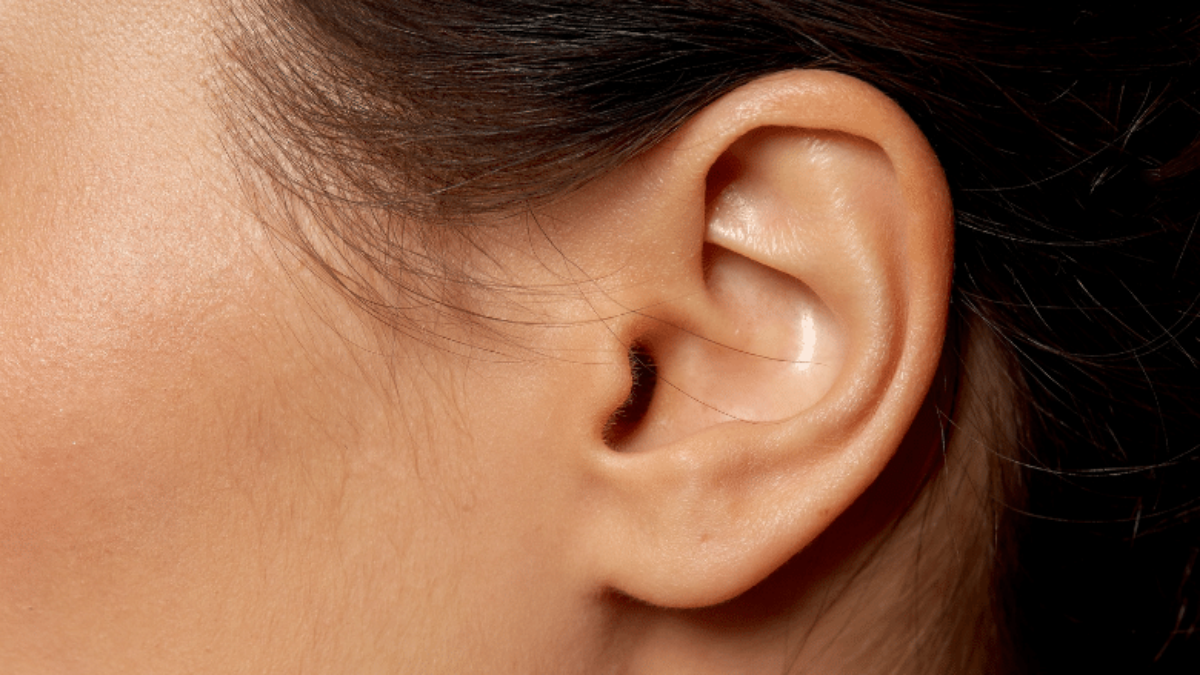 Otoplasty FAQs QA About Ear Reshaping Surgery